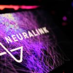 Neuralink e il chip N1 Link: l’innovazione supera i confini