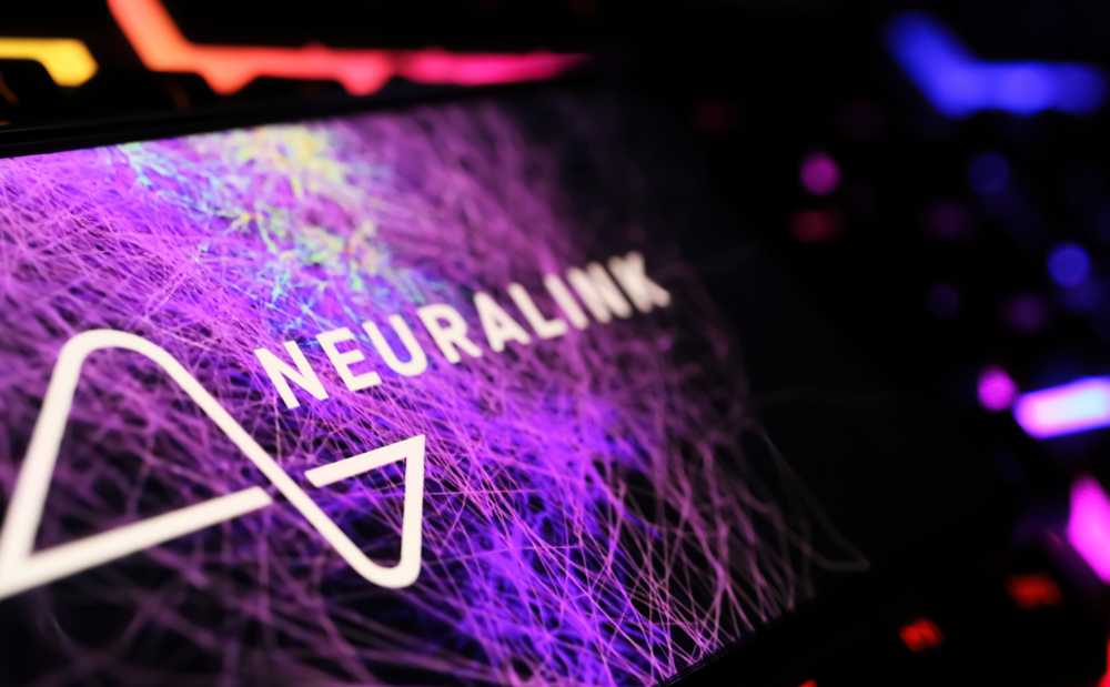 Neuralink e il chip N1 Link: l’innovazione supera i confini
